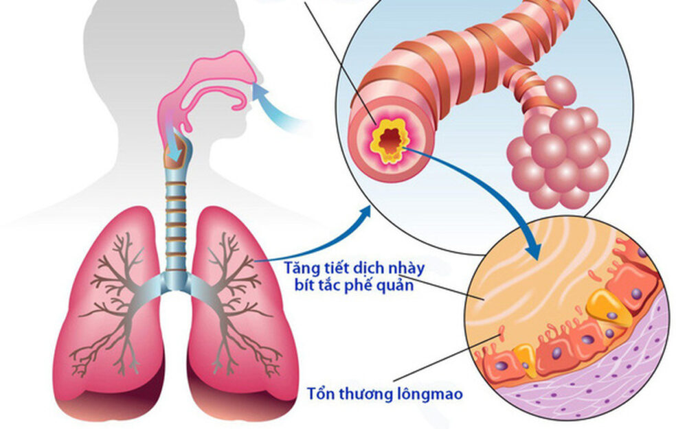 Theo y học hiện đại phế là gì được hiểu là phổi