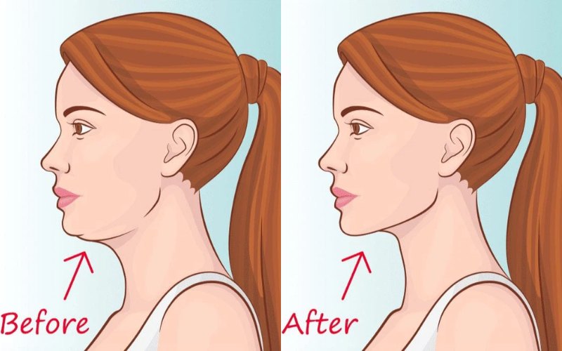 Tập Mewing cải thiện đường nét gương mặt giúp mũi trông cao hơn